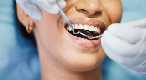 Best Walk-In Emergency Dental Services in Marietta, OH
